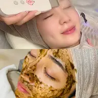 【ハイドラフェイシャル×ハーブピーリング】