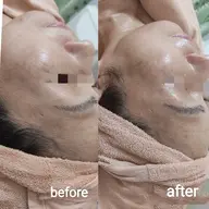 毛穴洗浄+白泥洗顔