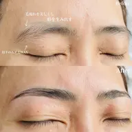 【ハリウッドブロウリフト】