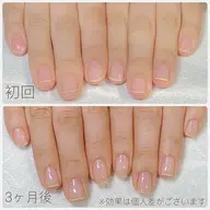 【最強のネイルケア】3ヶ月8回自爪育成コース ✨深爪矯正・自爪育成・爪トラブル✨縦長の美爪に育成✨オフィスネイル◎