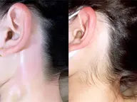 《360°美肌》顔​〜​首まわり丸ごと WAX（全顔+顎下+首下+うなじ）