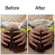 【脳疲労スッキリ】小顔ドライヘッドスパ