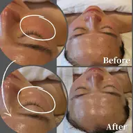 [オプション]ミニフェイシャル30分