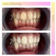 口コミを投稿頂ける会員の方はこちらからご予約ください◎¥0