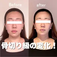 【人気No.1】整形級小顔へ！！ヘッドスパ＋オーダーメイド小顔矯正＋小顔オイルリンパ