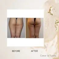 ヒップアップコース