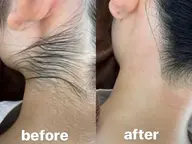 襟足・うなじWax✨✨浴衣やドレスの時のヘアアップスタイルも気にならない✨✨