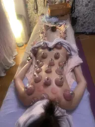 【リラクゼーション】アロマリンパ×カッピング120分【究極のデトックス】