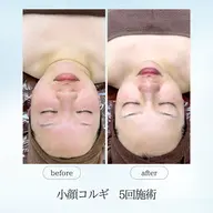 【他サロンにはない珍しいオリジナル】大人気整形級の小顔コルギ！オールハンドで腕、背中、首、顔、頭までしっかりほぐします✨