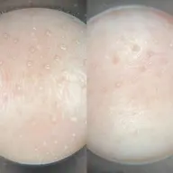 大人気！毛穴汚れさようなら！滑らか肌作りエステ