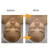 美白透明感アップ⤴️ホワイトニングコース