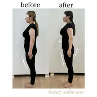 ＂今だけ半額＂【プレミアム｜全身美容矯正＋美顔器】選べるフェイスorデコルテ！EMSで引き締め&肌質改善