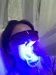 【歯のホワイトニング🦷✨】まずはお試し♡1セット（8分✖️2回）