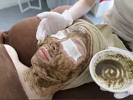 2B Bio ハーブピーリング ※剥けます