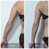 ミニモ限定!短時間でほっそり二の腕集中!!お写真提供可能な方