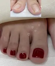 フット2本巻き爪ケア➕10本ワンカラー、デザイン変更可能