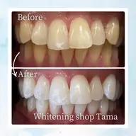 【メンズホワイトニング40分¥2,300🦷✨】施術後の口コミをお願いします👀