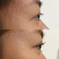 パリジェンヌラッシュリフト&まつ毛トリートメント