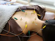 🌷美容鍼🌷(口コミ割)