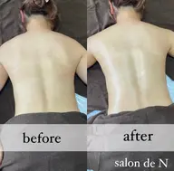 『痩身エステ』上半身or下半身