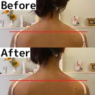 人気部位エステ🌿(肩、首、背中、二の腕、ふくらはぎ) どんどん体が軽くなっていきます✨✨