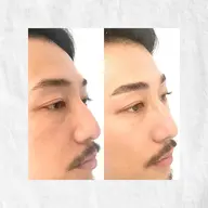 メンズアイブロウスタイリング/ワックス脱毛&毛量調整