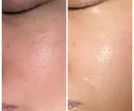 BA写真モニターメニュー📷お客様のお悩みに合わせたメニューをチョイス✨目隠し写真でも◎