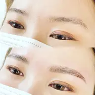 ハリウッドブロウリフト