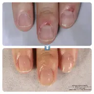 ジェルやアクリルを使用しない自爪育成/最強のネイルケア(お試し1回カウンセリング)