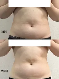 柔軟性＆血流促進！【溜めない体へ】全身リンパデトックス身90分コース　¥11,000