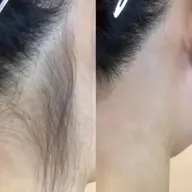 うなじ美人コース🎀口コミ🈹補足必読❣️メンズ🉑