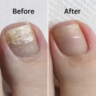 フットケア👣かかと・足裏ガサガサ角質ケア&自爪すっきり甘皮ケア✨他コースと併せてのご予約は、コース料金+¥4500✨