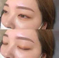 【新規】アイブロウWAX脱毛+フルフェイスWAX脱毛※眉を生やしてご来店下さい。