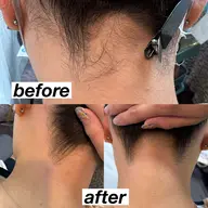 【4.5月限定】うなじWAX脱毛🩶