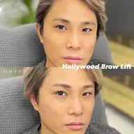 【メンズ眉毛】ハリウッドブロウリフト