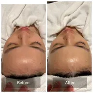 ✨️人気1位✨高保湿/2Step工程