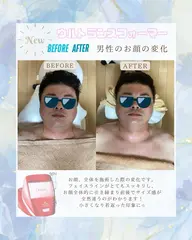 【フェイシャルケア】フェイスラインやデコルテをスッキリしたい方におすすめ🍑🩵ブライダルや特別な予定の前のケアにも💗