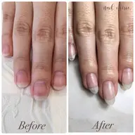 自爪育成🌼オフケア込み ¥9,000〜
