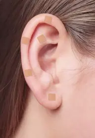 耳つぼ付け放題