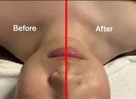 💆♀️フェイシャル💆♀️60分