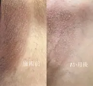 ROMA PINK 陰部 モニター定価より40%OFF