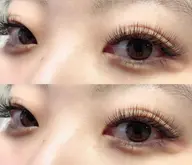 バインドロック100束