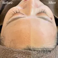 【すぐ予約OK】大人気!うるつや肌☆全顔フェイスワックス脱毛/メンズも可👩🏻👨🏻