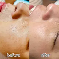 艶肌フェイシャルWAX1回+鎮静パック　ツヤツヤもちもちたまご肌へ