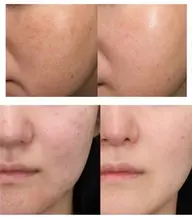 グルタチオン100%原液導入【選べる美容液】