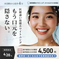 国内最高65Wマシン・40分照射ホワイトニングが初回限定価格！プランお申込みで初回無料になります！