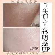 お肌悩みカウンセリングのみ