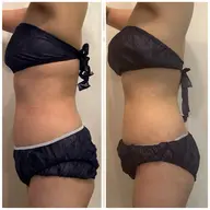 オーダーメイド温熱エステ120分〈贅沢全身ケア、リフレッシュに！〉