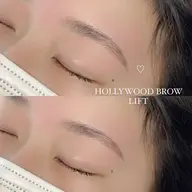 ハリウッドブロウリフト