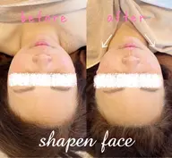 【小顔矯正＋ヘッド】《大口式シャープンフェイス》で自分史上最小の小顔を目指す☆頭のカタチも小さく丸く♪/自律神経整えケア